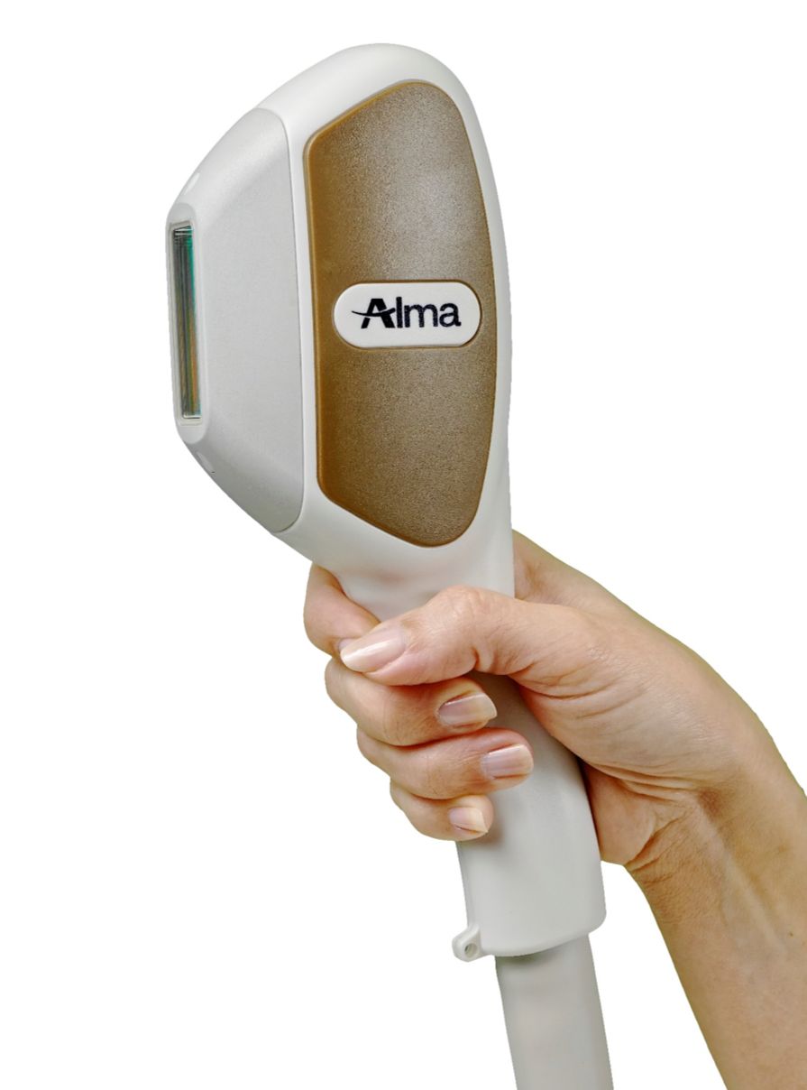 Alma SHR Laser Hair Removal